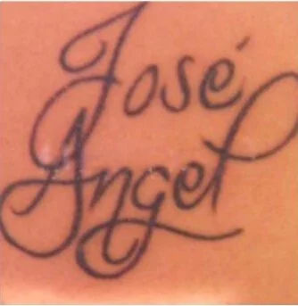 Tatuaje de letras negras 'José Ángel' en el brazo antes de empezar el tratamiento láser en Clínica Elimint, Valencia