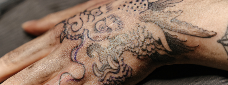 Borrar Tatuajes Valencia 2