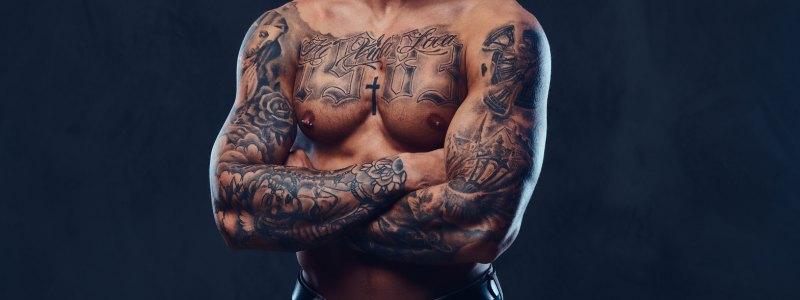 Láser para Quitar Tatuajes