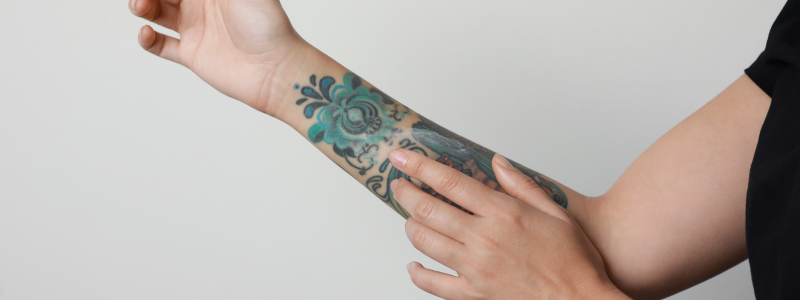 Eliminar tatuajes con láser