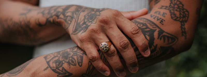 Eliminar tatuajes precio