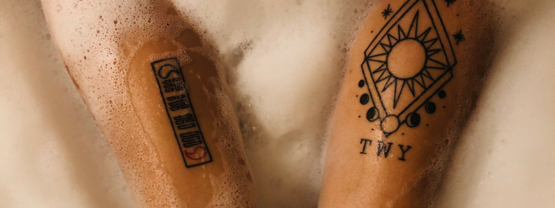 Eliminar tatuajes precio