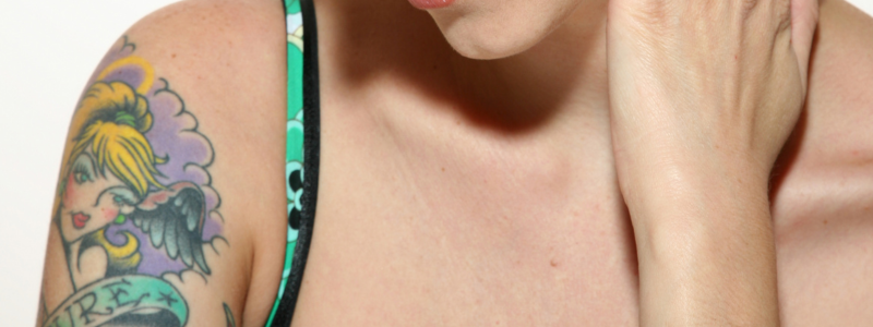Quitar Tatuajes en Castellón